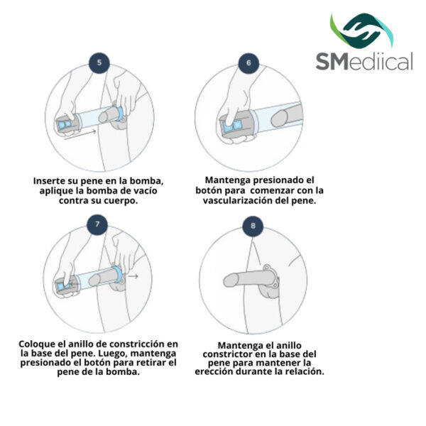 Terapia de vacío para la disfunción eréctil - Imagen 9